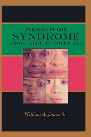 The Skin Color Syndrome Among African-Americans de Sr. William a. James