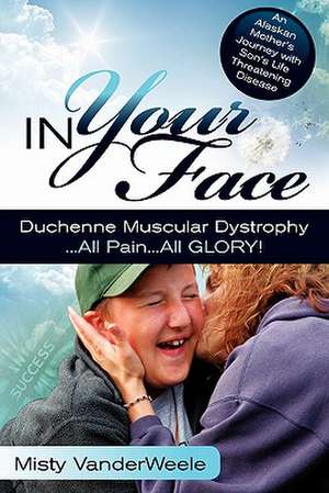 In Your Face Duchenne Muscular Dystrophy All Pain All Glory de Misty Vanderweele