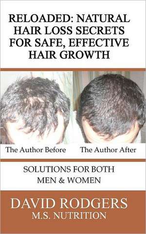 Reloaded: Natural Hair Loss Secrets for Safe, Effective Hair Growth de David Rodgers M. S.