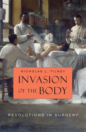 Invasion of the Body – Revolutions in Surgery de Nicholas L Tilney