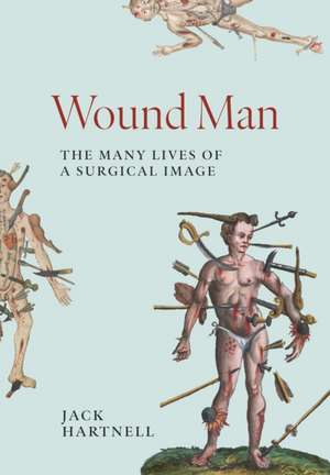 Wound Man de Jack Hartnell