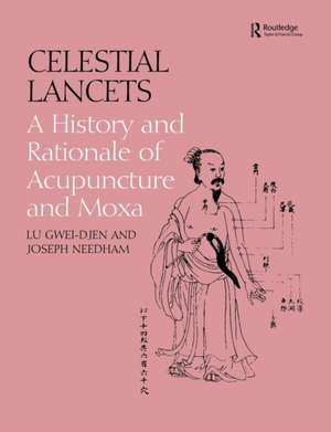 Celestial Lancets: A History and Rationale of Acupuncture and Moxa de Gwei-Djen Lu