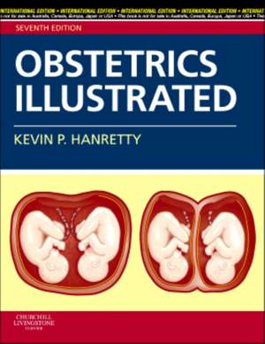 Obstetrics Illustrated de HANRETTY K. P.