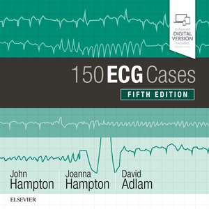 150 ECG Cases de John Hampton