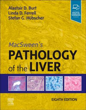 MacSween's Pathology of the Liver de Alastair D. Burt