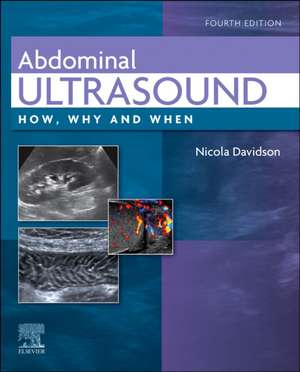 Abdominal Ultrasound: How, Why and When de Nicola Davidson