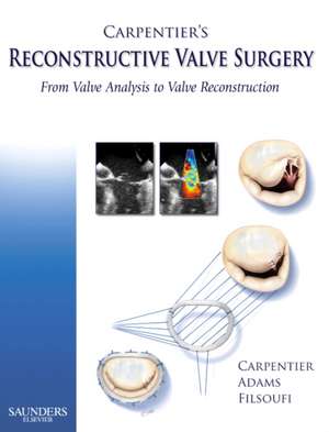 Carpentier's Reconstructive Valve Surgery de Alain Carpentier