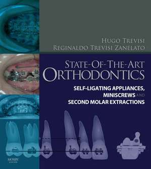 State-of-the-Art Orthodontics: Self-Ligating Appliances, Miniscrews and Second Molars Extraction de Hugo Trevisi