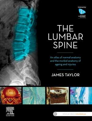 The Lumbar Spine: An Atlas of Normal Anatomy and the Morbid Anatomy of Ageing and Injury de James Taylor