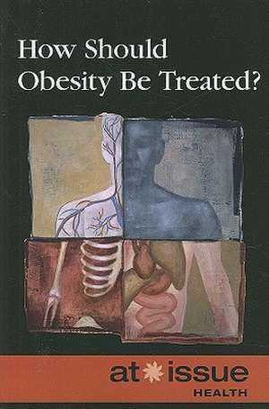 How Should Obesity Be Treated? de Stefan Kiesbye