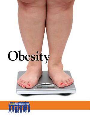 Obesity de Lauri S. Scherer