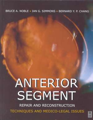 Anterior Segment Repair and Reconstruction: Technical and Medico-Legal Issues de Bruce A. Noble