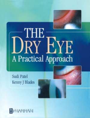 The Dry Eye: A Practical Approach de Sudi Patel