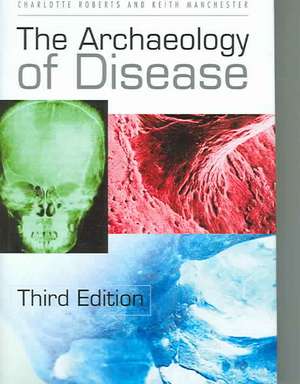 Roberts, C: The Archaeology of Disease de Charlotte A. Roberts