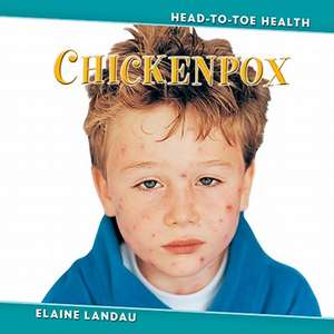 Chickenpox de Elaine Landau