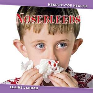 Nosebleeds de Elaine Landau