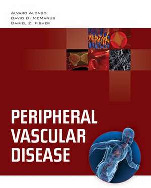 Peripheral Vascular Disease de Alvaro Alonso