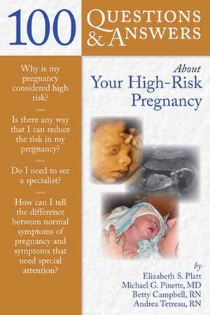 100 Questions & Answers about Your High-Risk Pregnancy de Elizabeth S. Platt