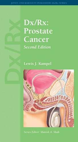 DX/RX: Prostate Cancer de Lewis J. Kampel