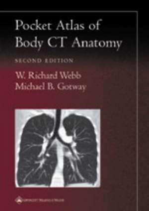 Pocket Atlas of Body CT Anatomy de W. Richard Webb