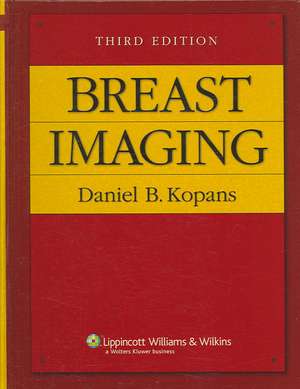 Breast Imaging de Daniel B. Kopans MD,