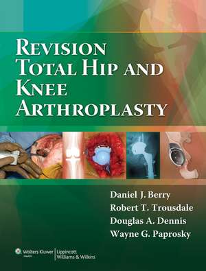 Revision Total Hip and Knee Arthroplasty de Daniel J. Berry MD