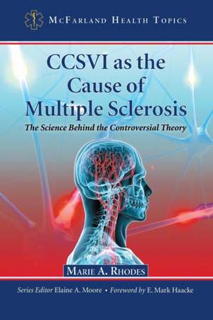 CCSVI as the Cause of Multiple Sclerosis: The Science Behind the Controversial Theory de Marie A. Rhodes