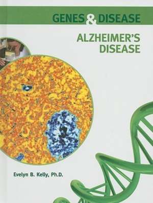 Alzheimer's Disease de Evelyn B. Kelly