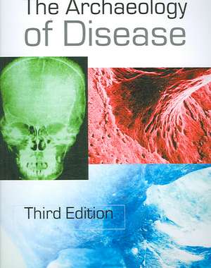 The Archaeology of Disease de Charlotte Roberts