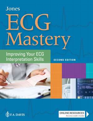 ECG Mastery de Shirley A. Jones