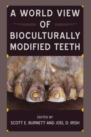 A World View of Bioculturally Modified Teeth de Scott E Burnett