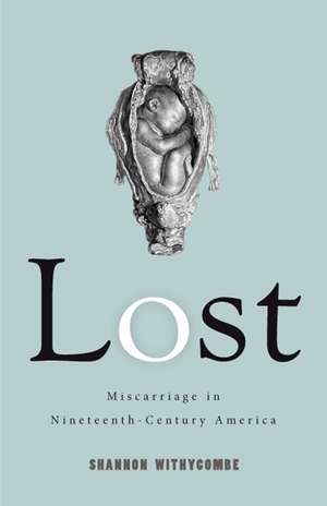 Lost: Miscarriage in Nineteenth-Century America de Shannon Withycombe