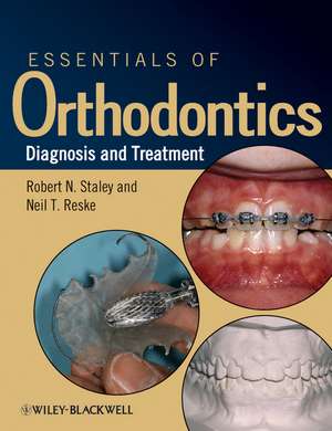 Essentials of Orthodontics – Diagnosis and Treatment de RN Staley