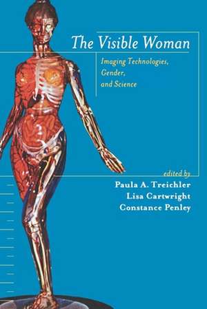 The Visible Woman – Imaging Technologies, Gender, and Science de Paula Treichler