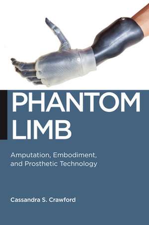 Phantom Limb – Amputation, Embodiment, and Prosthetic Technology de Cassandra S. Crawford