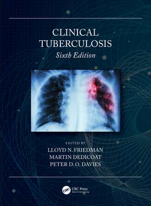 Clinical Tuberculosis de Lloyd N. Friedman