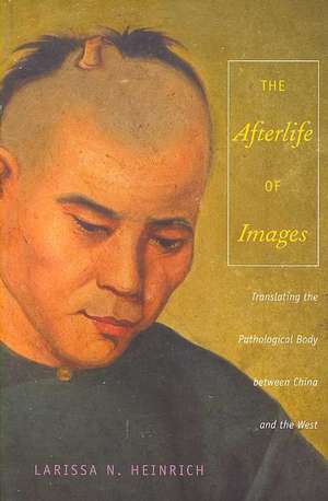 The Afterlife of Images – Translating the Pathological Body between China and the West de Ari Larissa Heinrich