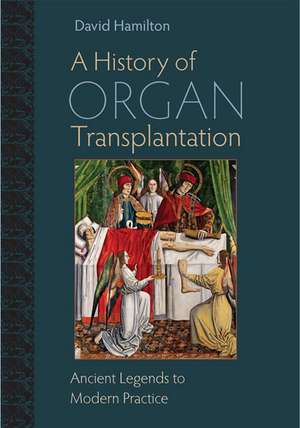 A History of Organ Transplantation: Ancient Legends to Modern Practice de David Hamilton