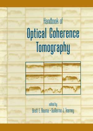 Handbook of Optical Coherence Tomography de Brett Bouma