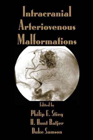 Intracranial Arteriovenous Malformations de Philip E. Stieg