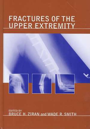 Fractures of the Upper Extremity de Bruce H. Ziran