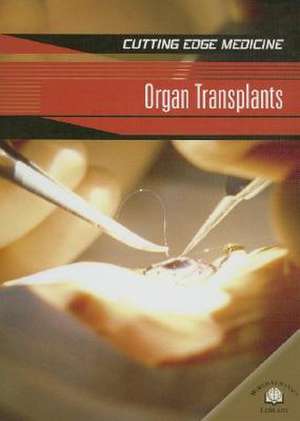 Organ Transplants de Carol Ballard