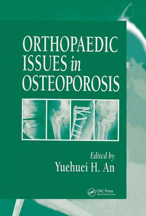 Orthopaedic Issues in Osteoporosis de Yuehuei H. An