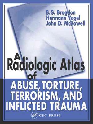 A Radiologic Atlas of Abuse, Torture, Terrorism, and Inflicted Trauma de B. G. Brogdon