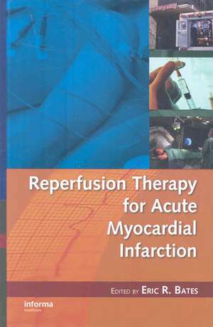 Reperfusion Therapy for Acute Myocardial Infarction de Eric R. Bates