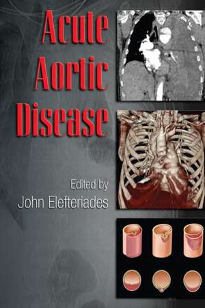 Acute Aortic Disease de John Elefteriades