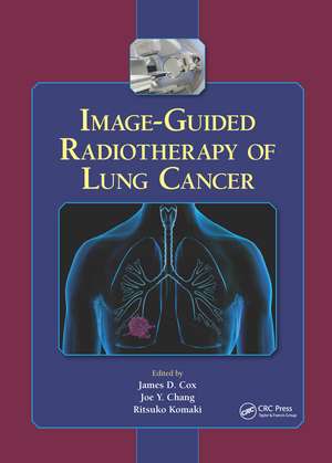 Image-Guided Radiotherapy of Lung Cancer de James D. Cox