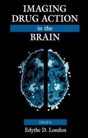 Imaging Drug Action in the Brain de Edythe D. London