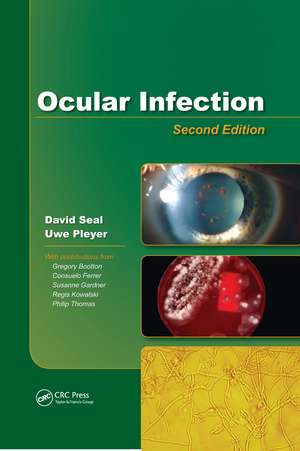 Ocular Infection: Investigation and Treatment in Practice de David V. Seal