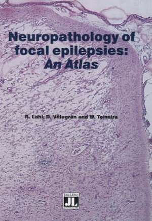 Neuropathology of Focal Epilepsies de W. Teixeira